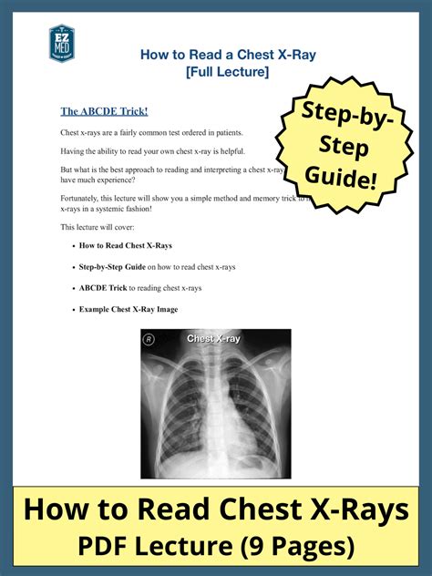 How to Read Your Chest X.